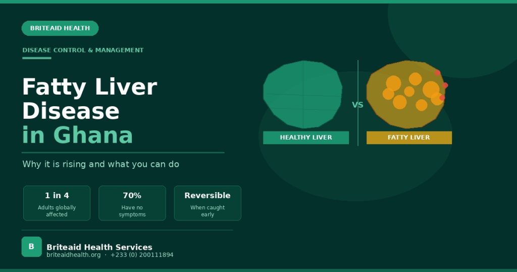 Fatty liver disease diagram showing healthy vs fatty liver — Briteaid Health Ghana